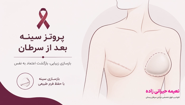پروتز سینه بعد از سرطان برای چه کسانی مناسب است؟